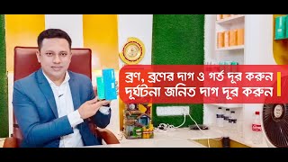 ব্রণব্রণের দাগ ও ব্রণের গর্ত দূর করার উপায়। Acne Acne Spot amp Scar Products  01966556699 [upl. by Adnohsel317]