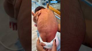 This Growth Hair Babymedical newbornbaby viralvideo [upl. by Jaymee]