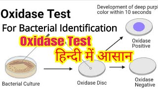 Oxidase test in hindi  Bacterial identification  Microbiology [upl. by Fagaly719]