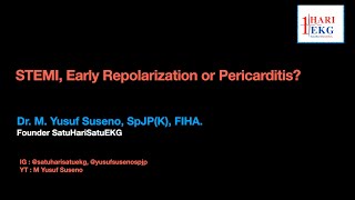 STEMI NSTEMI or Early Repolarization Pattern De Winter Sign Hyperacute T 4 Variable Formula [upl. by Godric]