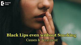 3 Reason why Lips are getting black even without smokingSolutionDrRashmi RavinderDoctors Circle [upl. by Aelber]