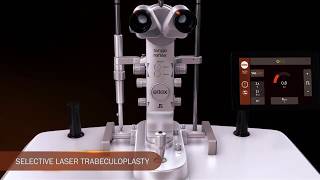 Ellex Selective Laser Trabeculoplasty SLT Animation [upl. by Ettesoj]