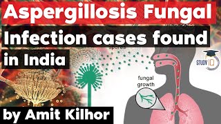 Aspergillosis Fungal Infection cases found in India  Deadlier than Black White amp Yellow fungus [upl. by Ennahs584]