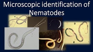 Microscopic identification of NematodesNematodesParasitologyMLSAscaris [upl. by Aleil]