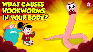 What causes Hookworm। Intestinal Worms Symptoms and Treatment  Worm Infection  Dr Binocs Show [upl. by Matias]