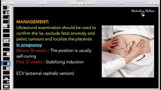 Malpresentation 2  OB course  Masterclass Medicine [upl. by Ayana]