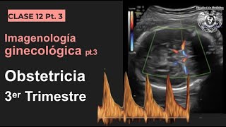 123  Imagen en Obstetricia 3er Trimestre [upl. by Anawahs]