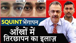 भेंगापन तीरछापन का इलाज  Near LIVE Squint Surgery Demonstration [upl. by Maxia]