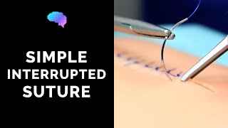 Simple interrupted suture wound suturing  OSCE Guide  UKMLA  CPSA [upl. by Sheets67]