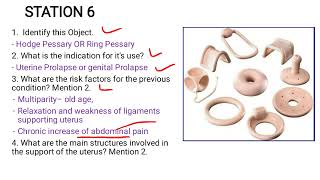 Ring Pessary  Case Study [upl. by Dlareme255]