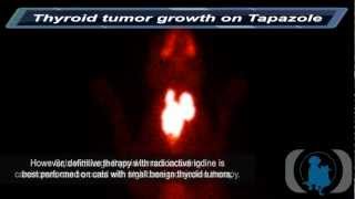 Thyroid Tumor Growth on Tapazole [upl. by Halyahs568]