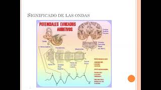 UT 13 y 14  Potenciales evocados y monitoreo Dra Corti [upl. by Indys]