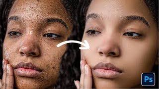 Skin Retouching  Best Photoshop Tutorial  Face Retouching [upl. by Kammerer]