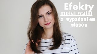 Efekty mojej walki z wypadaniem włosów [upl. by Ailssa989]