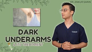 Dark Underarm Treatment  Dark Underarms Whitening  Acanthosis Nigricans  Dr Ankur Sarin [upl. by Itsirc776]