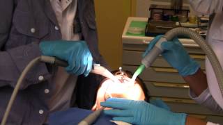 Tooth filling in school dental clinic Part 16 Last Tooth filling [upl. by Adnaval]