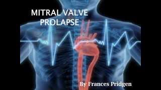 MITRAL VALVE PROLAPSE presentation [upl. by Tavis62]