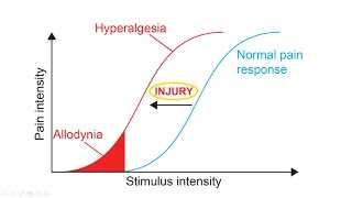 Hyperalgesia And Allodynia Explained  What is the definition of Hyperalgesia [upl. by Wendelina]