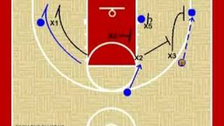 Basketball Defense  Diamond and 1  Junk Defense [upl. by Kelleher]