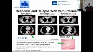 Ahmad Awada Thérapie biologique ciblée du mélanome [upl. by Jessee]