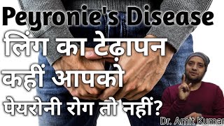 Peyronies Disease  पेयरोनी रोग लिंग का टेढ़ापन कहीं आपको पेयरोनी रोग तो नहींइसका करें 100 इलाज। [upl. by Lindy415]