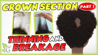 Crown SORENESS and BREAKAGE  Causes and Solutions Part 1 [upl. by Danita328]