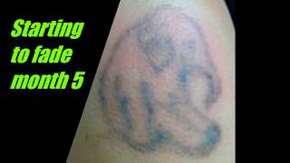 thINK Tattoo Removal Cream 2018 [upl. by Akena]