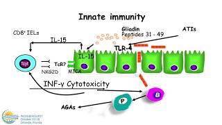 NonCeliac Gluten Sensitivity [upl. by Idnal556]